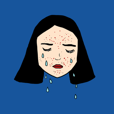 acne article pic 1.png