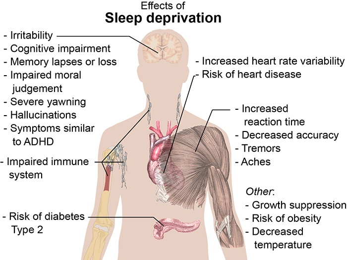 Effects_of_sleep_deprivation